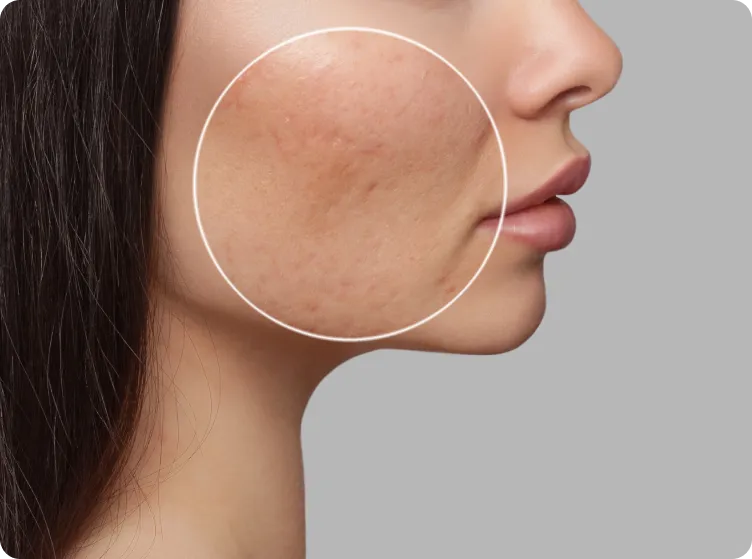 Image of skin pigmentation on face